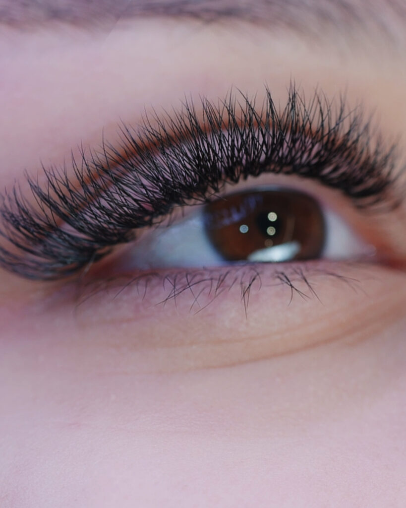 Eye-2