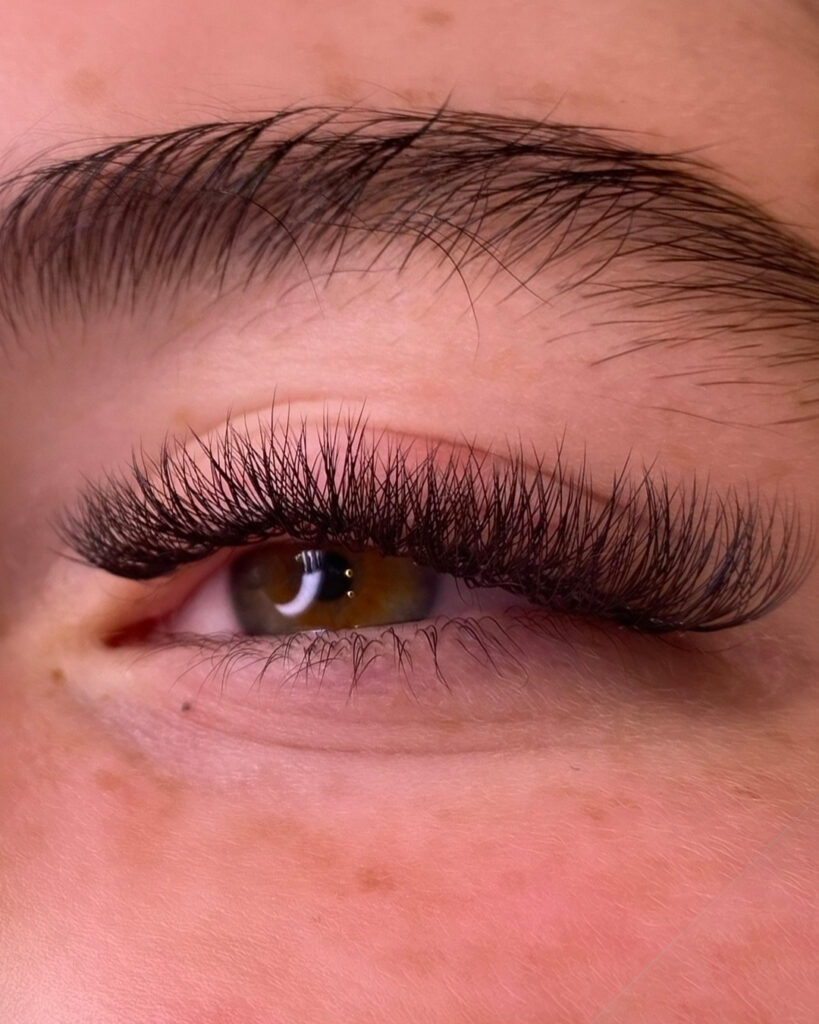 Eye-33
